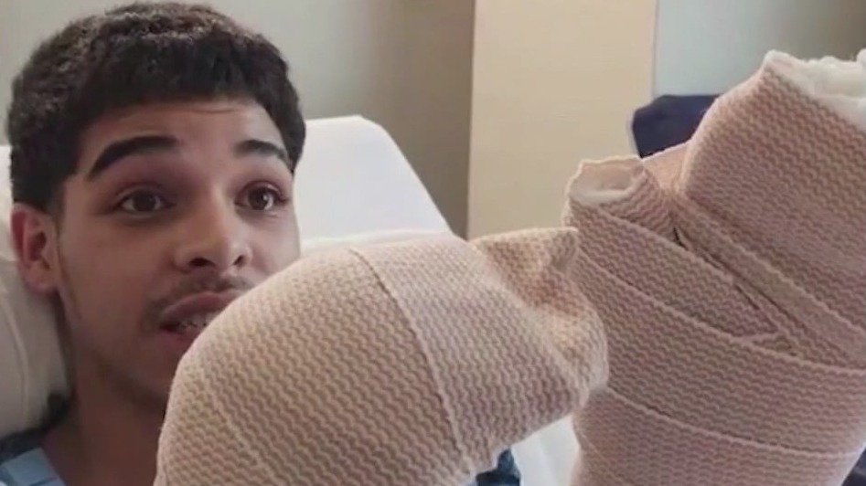 Federal lawsuit filed after teens shot by deputies